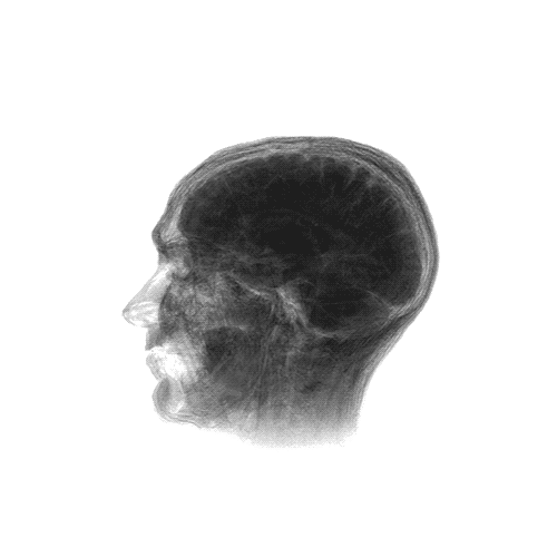 Rotating X-ray brain illustration